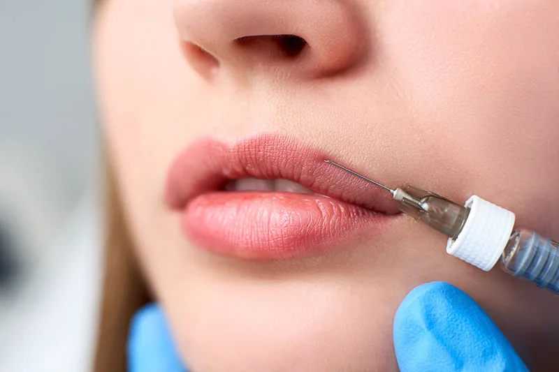 Dermal fillers | Dr Chalita le Roux Dermal Fillers| Roodepoort South Africa