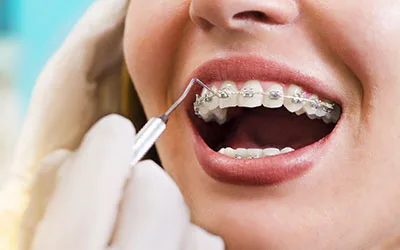 Orthodontics | Dr Chalita le Roux Orthodontics | Roodepoort South Africa