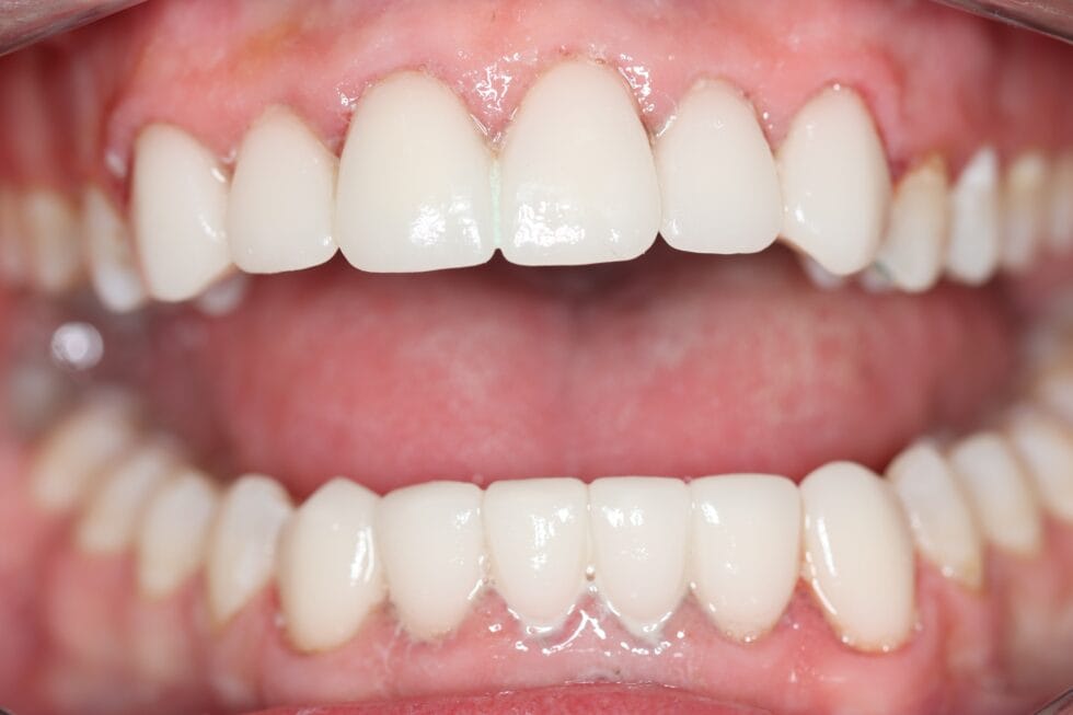 Same-day smile makeovers in Johannesburg