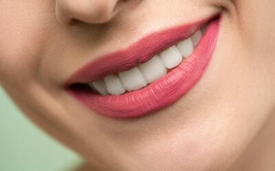 Professional Teeth Whitening Johannesburg — Your Complete Guide to a Brighter, Confident Smile