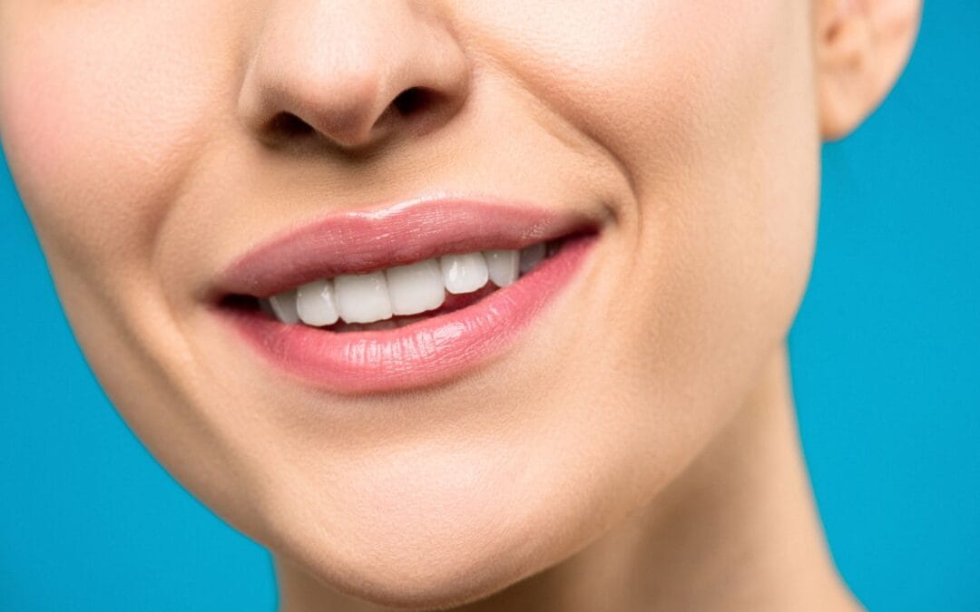 Bright, healthy smile after professional teeth whitening