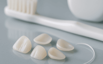 How to Care for Veneers (and How Long They Last)
